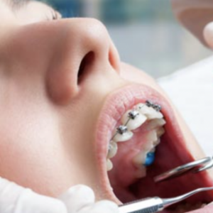 Orthodontic Dental Certification